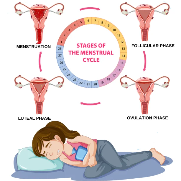 Illustration of the four stages of the menstrual cycle with a woman experiencing endometriosis.